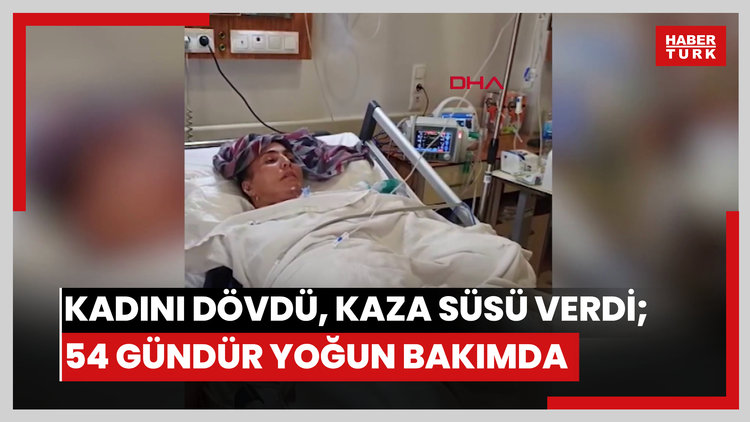 Eşinin dövüp, olayı kaza gibi göstermeye çalıştığı kadın, 54 gündür yoğun bakımda