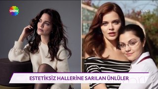 Estetiksiz hallerine sarılan ünlüler! 