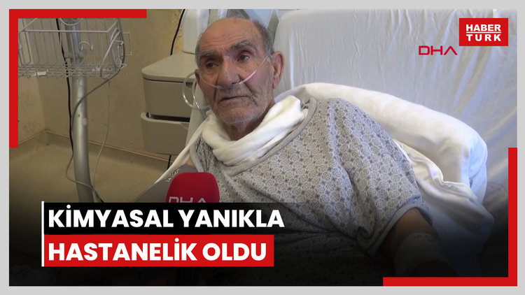 Tıkalı lavaboyu açmaya çalıştı, kimyasal yanıkla hastanelik oldu