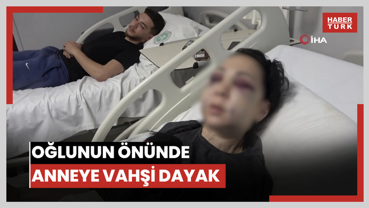 Oğlunun gözü önünde anneyi öldüresiye dövdüler: Yüzü tanınmaz halde