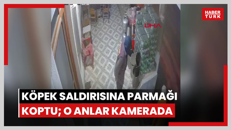 Köpek saldırısına parmağı koptu; o anlar kamerada