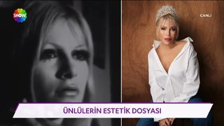 Ünlülerin estetik dosyası! 