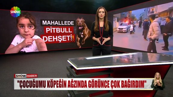 Azılı pitbull, çocuğa saldırdı! 