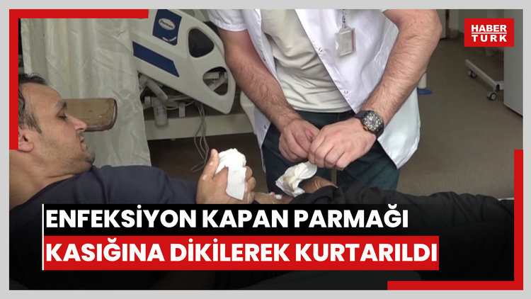 Enfeksiyon kapan parmağı kasığına dikilerek kesilmekten kurtarıldı