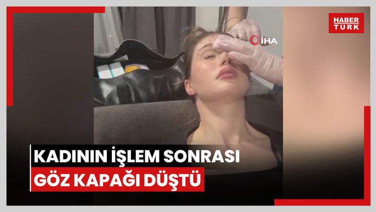 Zeytinburnu'nda botoks yaptıran kadının işlem sonrası göz kapağı düştü