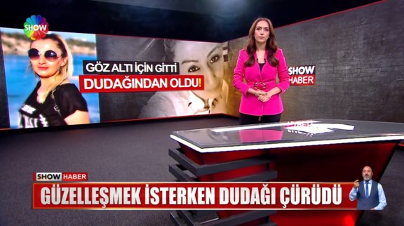 Güzelleşmek isterken dudağından oldu!