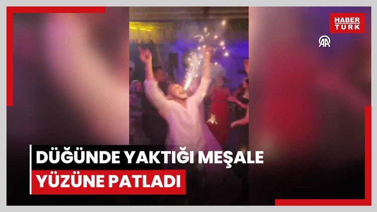 Düğünde yaktığı meşale yüzüne patladı