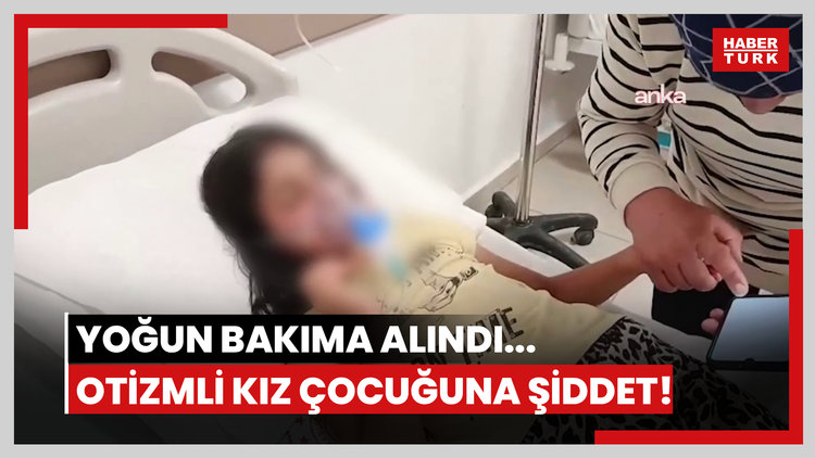 Yoğun bakıma alındı... Otizmli kız çocuğuna komşu şiddeti!