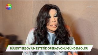 Bülent Ersoy'un gündem olan estetikleri!