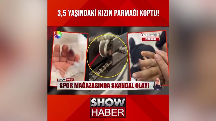 Bisiklet, parmağını kopardı!