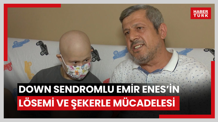 Down sendromlu Emir Enes'in hem lösemi hem şekerle mücadelesi