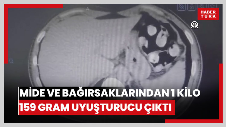 Kırşehir'de mide ve bağırsaklarında 1 kilo 159 gram uyuşturucu ele geçirilen zanlı tutuklandı