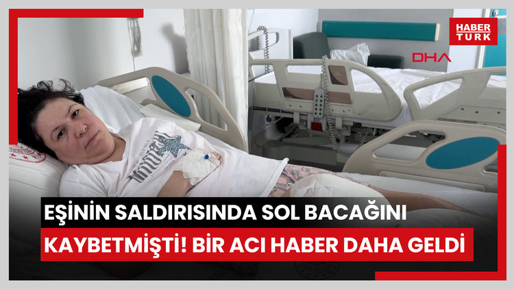 Eşinin saldırısında sol bacağını kaybetmişti! Bir acı haber daha geldi