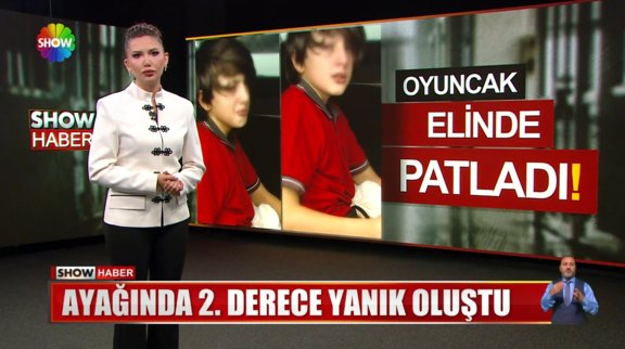 Stres oyuncağı elinde patladı!