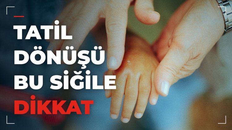 Yaz tatili dönüşü çocuklarda bu cilt sorununa dikkat!
